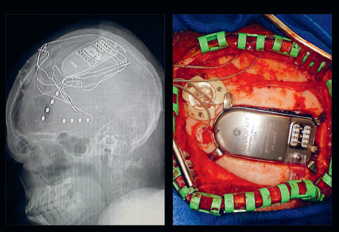 Lateral X-ray of the skull graphic