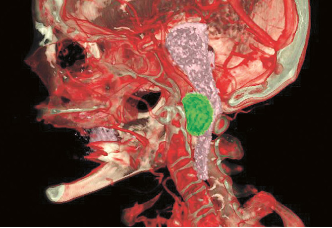 Neurology and Neurosurgery