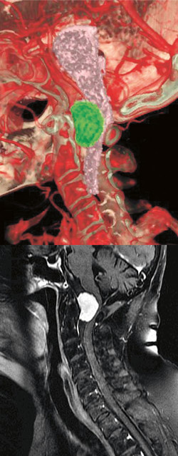 3D visualization of the patient’s craniospinal anatomy