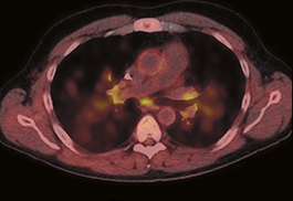 Pulmonary, Critical Care and Sleep Medicine