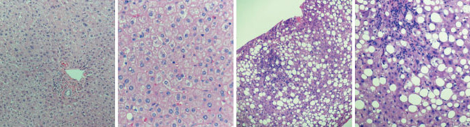 Four photos show standard hematoxylin and eosin-stained liver sections viewed by light microscopy