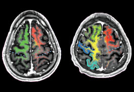 Neurology and Neurosurgery