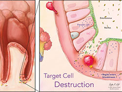 image of drawling of target cell destruction