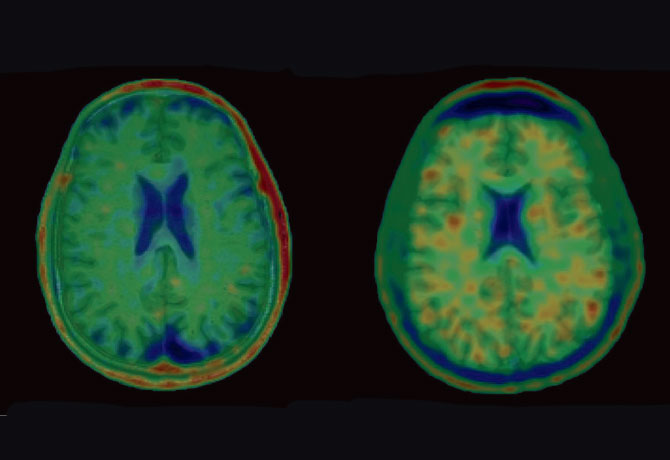 image of brain scans