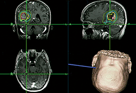 Neurology and Neurosurgery