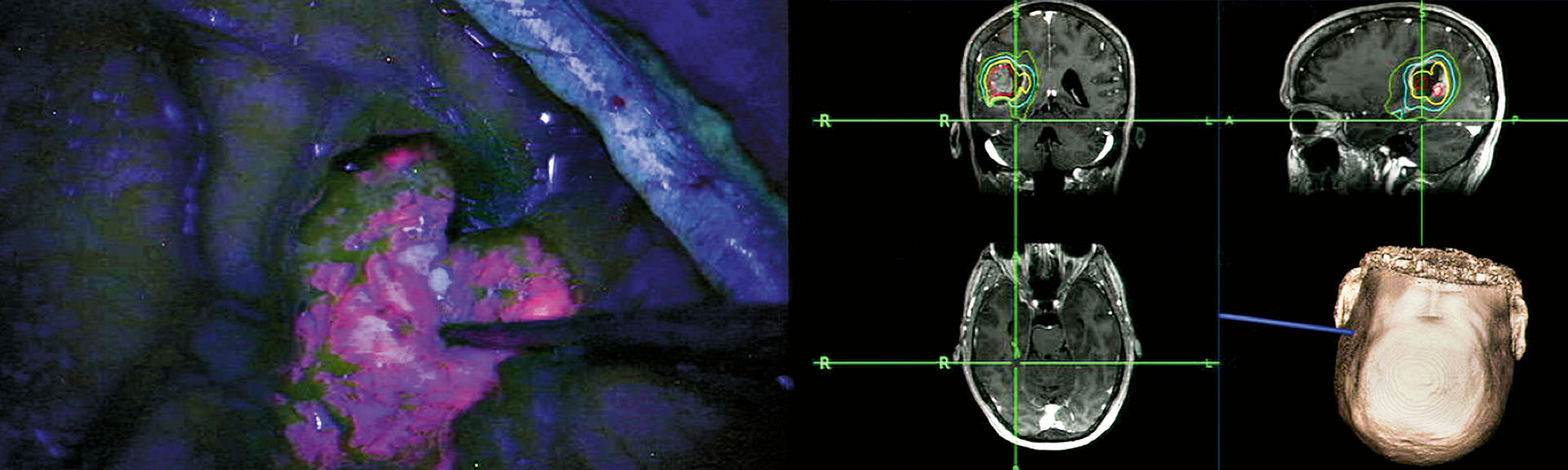 Cover_1920x575-Neuro.jpg