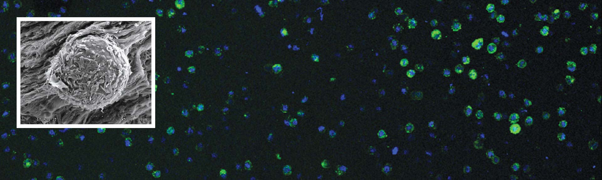Image shows staining for cell viability of annulus fibrosus cells seeded in fibrin-genipin hydrogel sealant at 24 hours