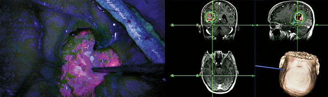 Neurology and Neurosurgery