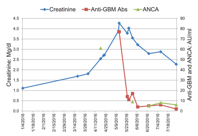 Graphic of Patient A.’s creatinine and anti-GBM antibodies