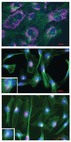 XFS Tenon Fibroblasts Display Dysfunctional Lysosomes. Under “starvation” conditions (without serum), lysosomes and autophagosomes relocate to the perinuclear area where they fuse, initiating the degradation of cellular waste that can be used to produce energy for the cell. These data demonstrate that lysosomes in tenon fibroblasts derived from XFS patients cannot relocate to the perinuclear area under starvation conditions suggesting that their degradative function is impaired.