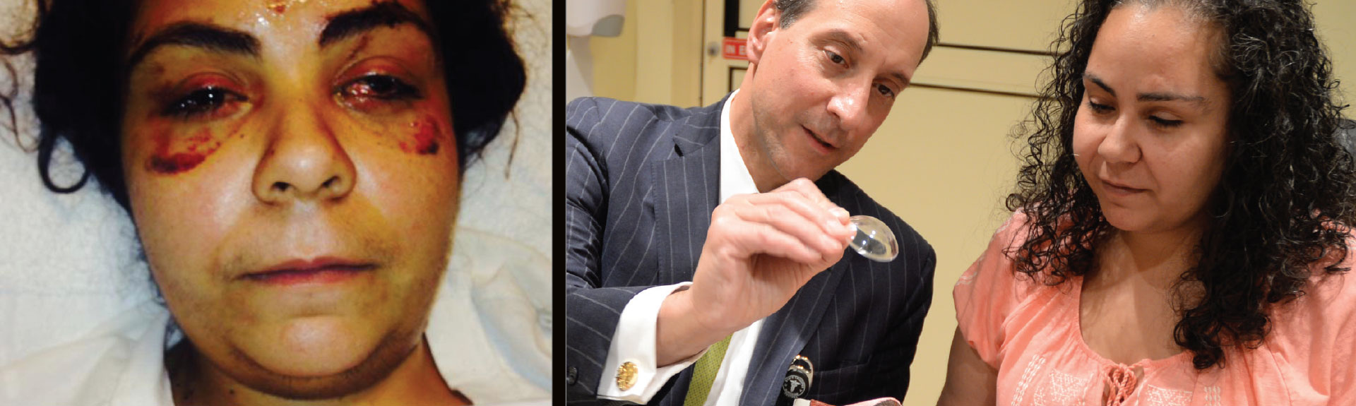A photo of Jullisa Marquez in the Emergency Department after sustaining knife injuries to head, face, and eyes. A second photo showing Ronald Gentile, MD, with Ms. Marquez during a follow-up visit three years later.