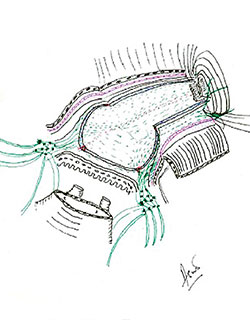 image of a sketch of a prostate