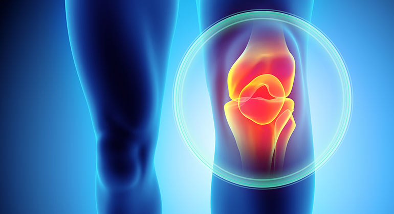 Do you have knee pain?