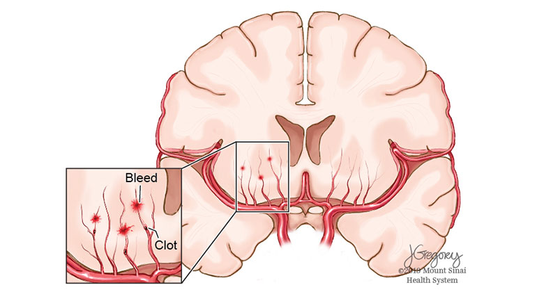 brain graphic