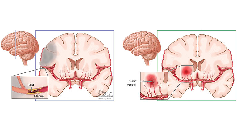 brain graphic