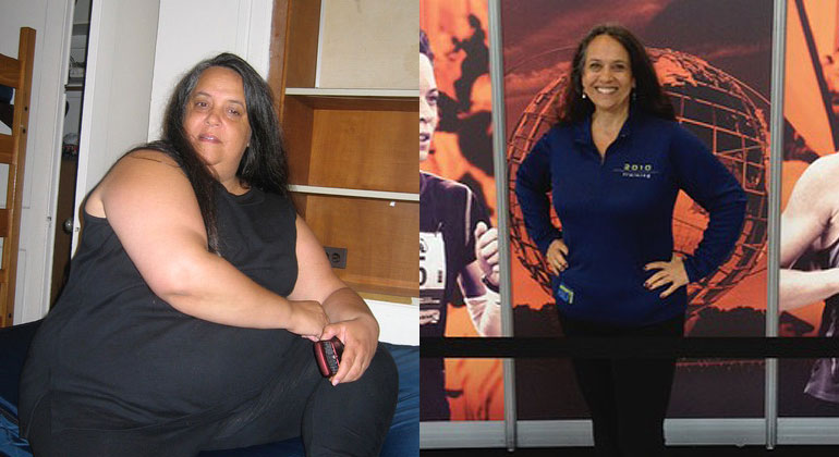 Before and after image of woman