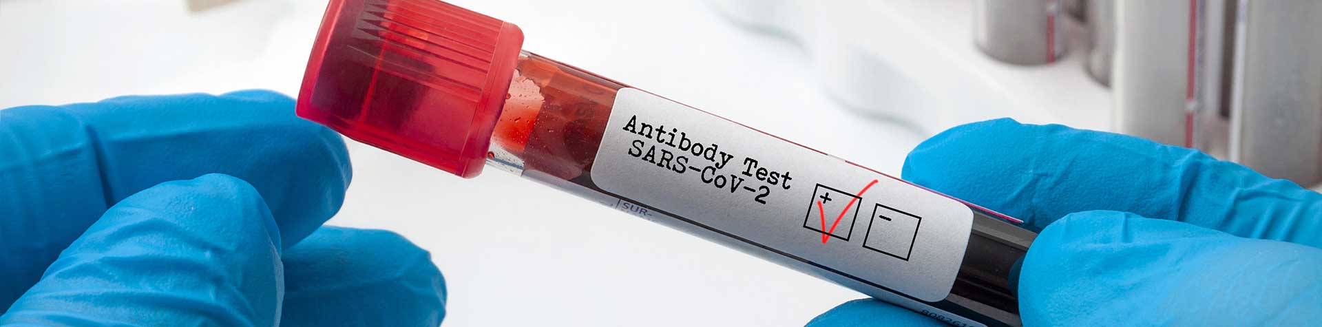 Gloved hands handling lab sample