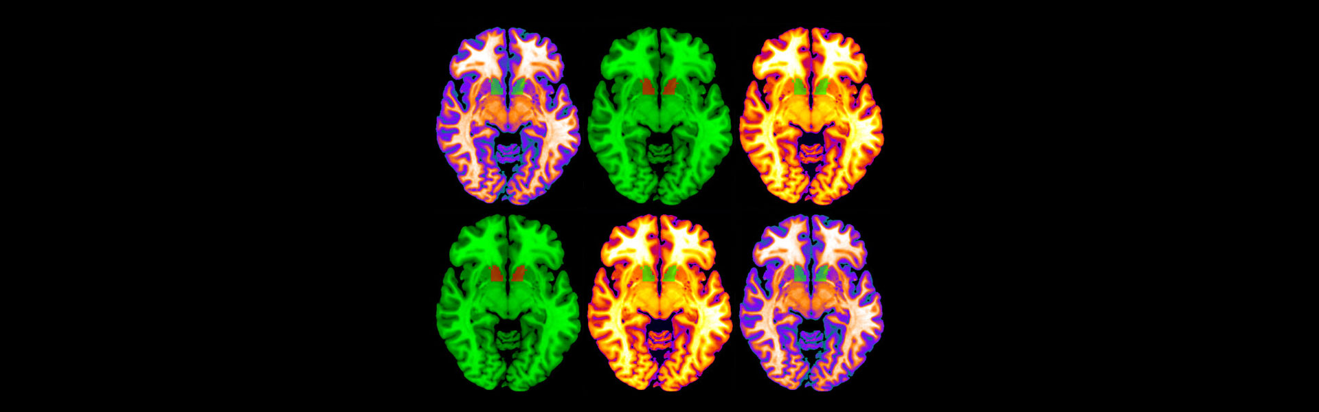 Brain Scan
