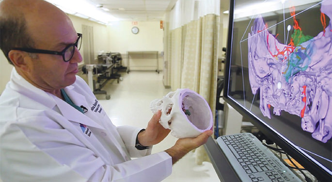 image of Dr. Bederson reviewing 3D printed brain model and comparing to brain scan on screen