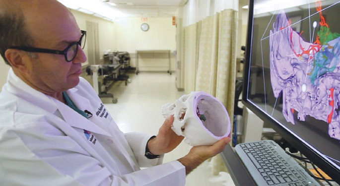 image of Dr. Bederson reviewing 3D printed model brain, comparing it to scan on screen