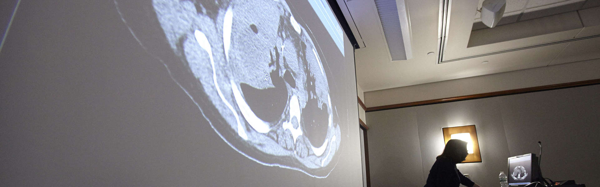 projection screen presentation about pulmonary studies