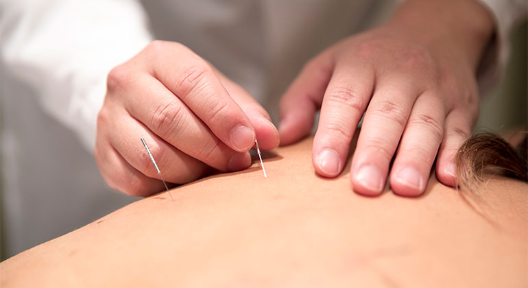 Interventional Spine Physiatry and Rehabilitation